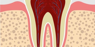Icon style image for blog: What Causes Teeth Staining?