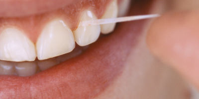 Icon style image for blog: Are Bleeding Gums Normal?